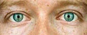 Die Augen von Mark Zuckerberg